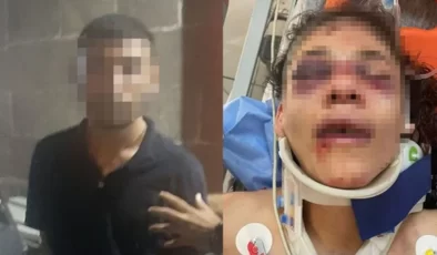 Birlikte Yaşadığı Kadını 51 Yerinden Bıçakladı…