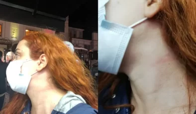 Polis Gazetecinin Boğazını Sıktı, Telefonuna El Koydu…