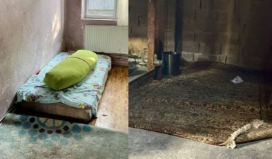 Altı Yaşındaki Nur Elif Yetersiz Beslenmeden Öldü…