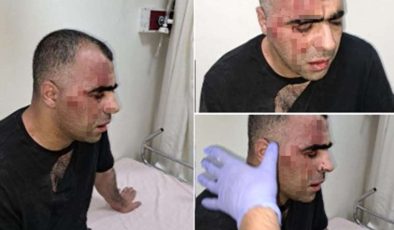 AKP’li Tatvan Belediye Başkanı’nın Korumaları Gazeteci Dövdü…