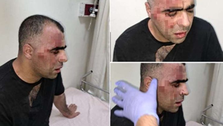 AKP’li Tatvan Belediye Başkanı’nın Korumaları Gazeteci Dövdü…