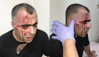 Sinan Aygül’e Saldırıan Koruma Polisi Açığa Alındı…